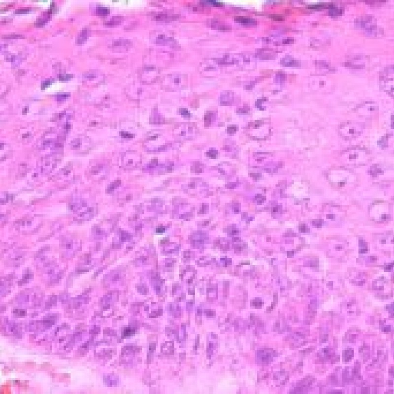 Otitis externa – die Entzündung des äußeren Ohres - hundkatzepferd